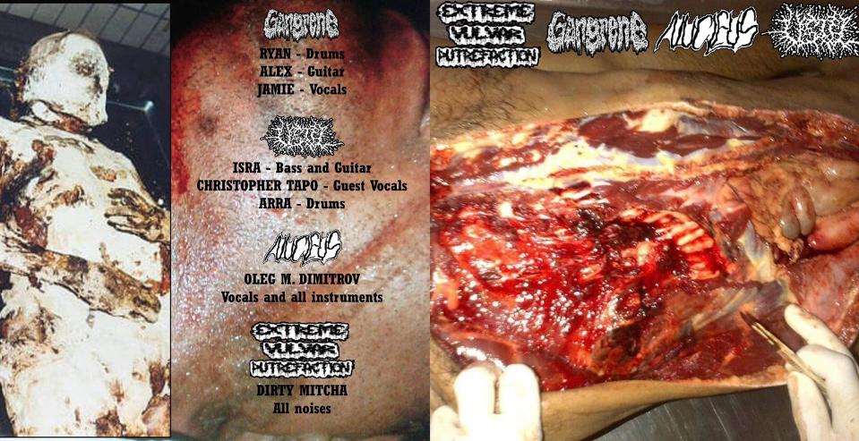 4-way split: Gangrene, USTEL, Nucleus eta Extreme Vulvar Putrefaction